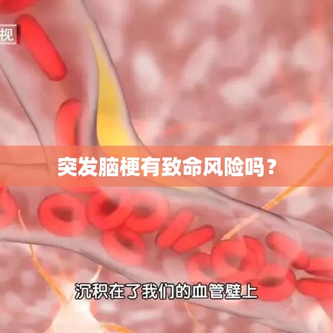 突發腦梗有致命風險嗎?