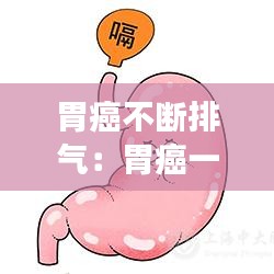 胃癌不斷排氣:胃癌一直放屁嗎