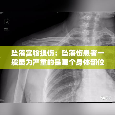墜落實(shí)驗損傷：墜落傷患者一般最為嚴(yán)重的是哪個身體部位 