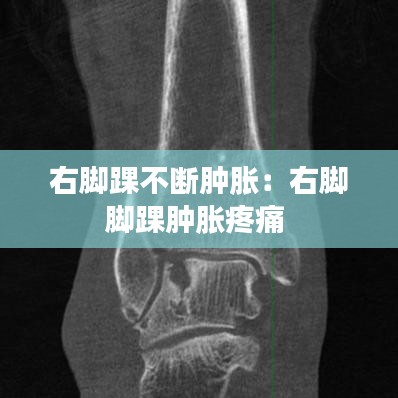 右腳踝不斷腫脹:右腳腳踝腫脹疼痛