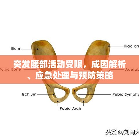 突發(fā)腰部活動受限,成因解析、應急處理與預防策略
