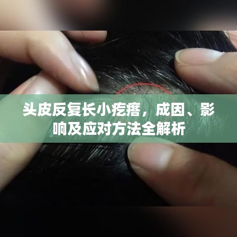 頭皮反復長小疙瘩,成因、影響及應對方法全解析