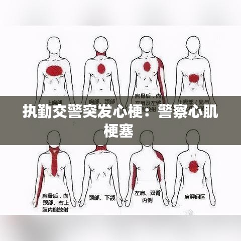 執勤交警突發心梗:警察心肌梗塞