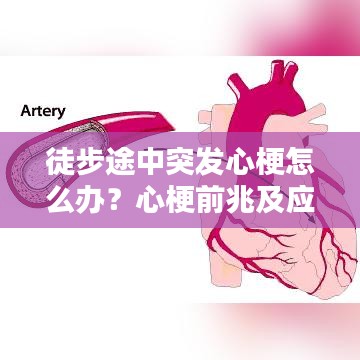 徒步途中突發(fā)心梗怎么辦?心梗前兆及應(yīng)對措施科普!