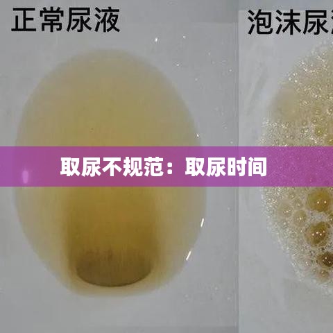 取尿不規范:取尿時間