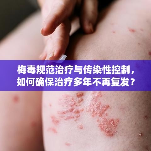梅毒規范治療與傳染性控制,如何確保治療多年不再復發?