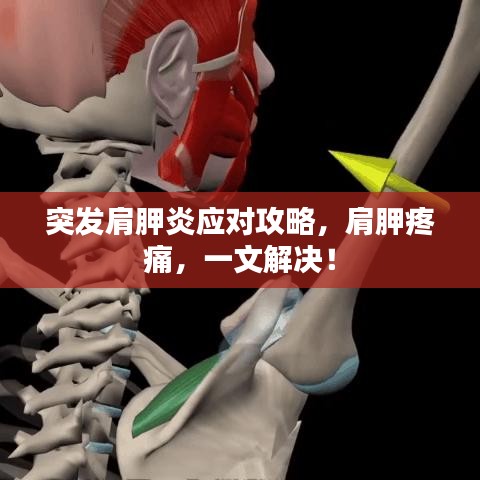 突發(fā)肩胛炎應(yīng)對(duì)攻略,肩胛疼痛,一文解決!