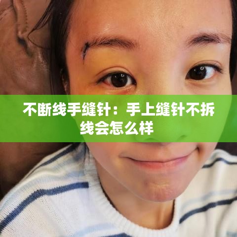 不斷線手縫針:手上縫針不拆線會(huì)怎么樣