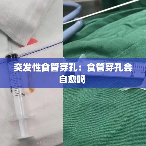 突發性食管穿孔:食管穿孔會自愈嗎