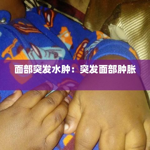 面部突發(fā)水腫:突發(fā)面部腫脹