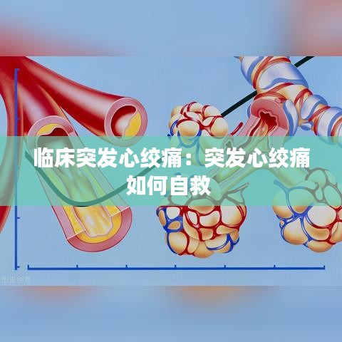 臨床突發心絞痛:突發心絞痛如何自救