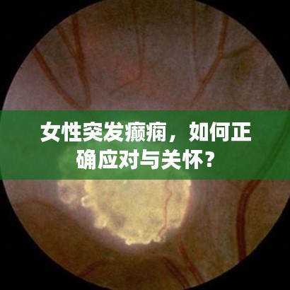 女性突發癲癇,如何正確應對與關懷?