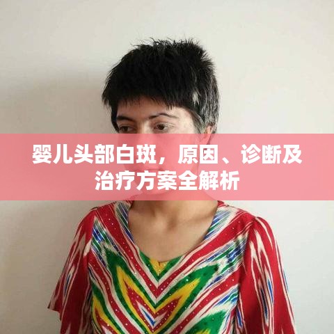 嬰兒頭部白斑,原因、診斷及治療方案全解析