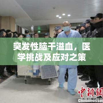 突發性腦干溢血，醫學挑戰及應對之策