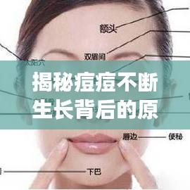 揭秘痘痘不斷生長(zhǎng)背后的原因,深層解析成因與應(yīng)對(duì)之道