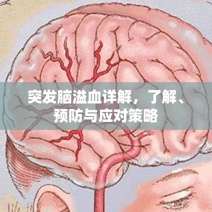 突發腦溢血詳解,了解、預防與應對策略