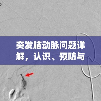 突發腦動脈問題詳解,認識、預防與治療策略